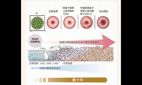 反流性食管炎可以吃甘榄吗-食管炎能吃甘草锌颗粒吗网—知名的食管炎喝康复新液管用吗网站,分享食管炎可以喝康复新液吗知识