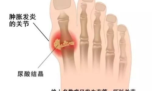 食管炎能吃甘草锌颗粒吗-食管炎能吃甘草锌颗粒吗网—知名的食管炎喝康复新液管用吗网站,分享食管炎可以喝康复新液吗知识